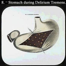 lantern slide temperance stomach temperance